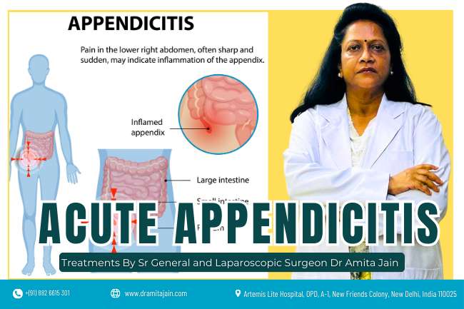 best surgeon for Acute Appendicitis - Dr Amita Jain
